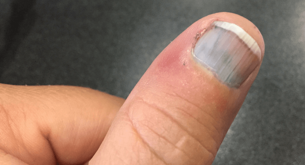 What the shape of your thumbnail might reveal about you